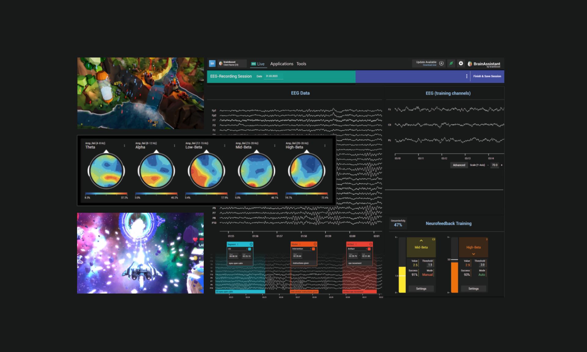 Rewire your brain through brain-maps based neurofeedback